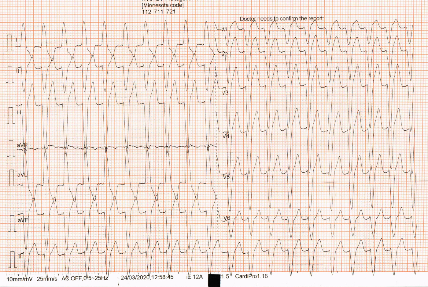 RAMADASS awmi  svt CHANGES001.jpg